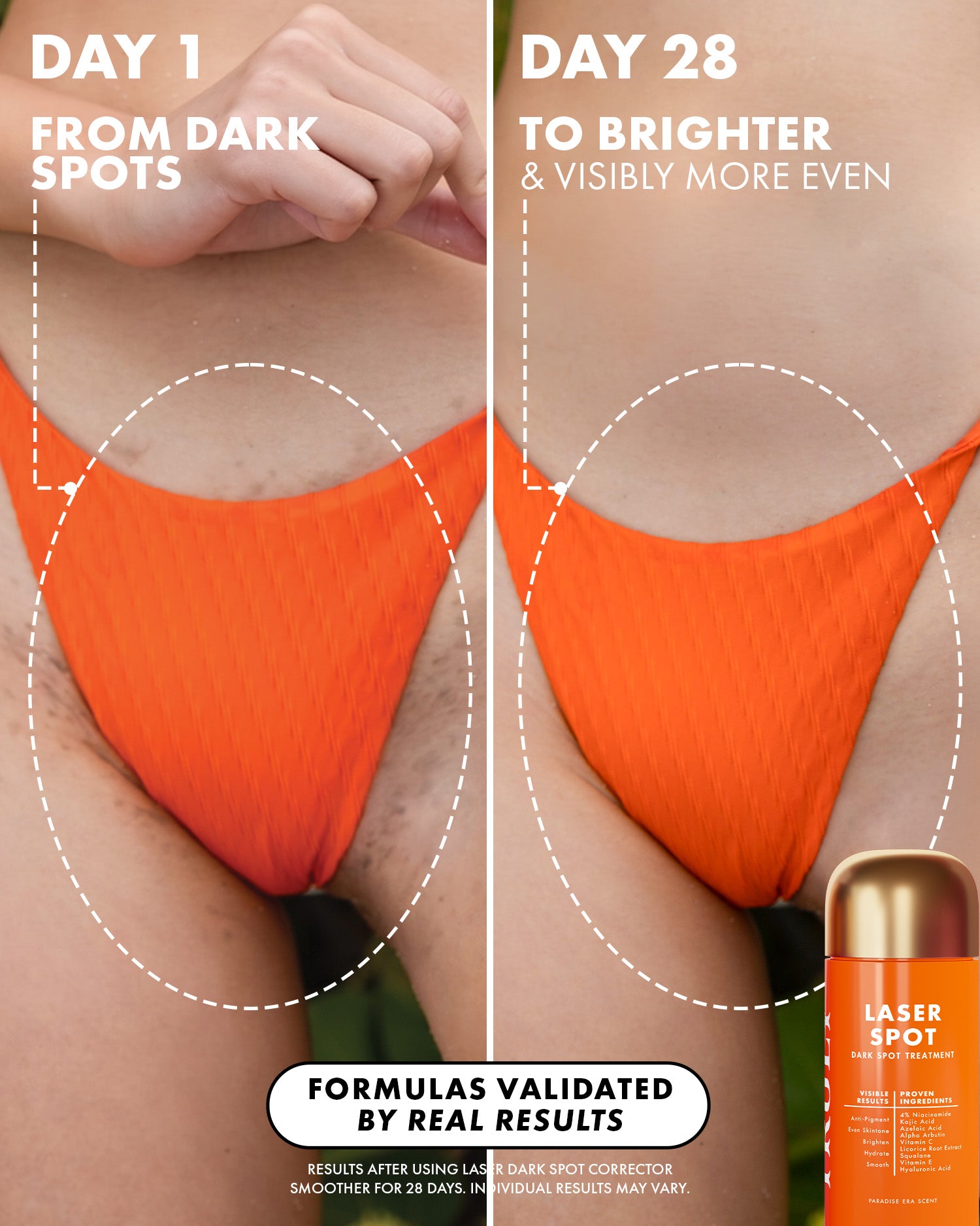 03_BeforeAfter_UltimateBodySculptingKit_Truly_Amazon_PDP_1500x1875_ef6d74cc-3b0c-4e88-91d5-d12a44b0ee7f.jpg