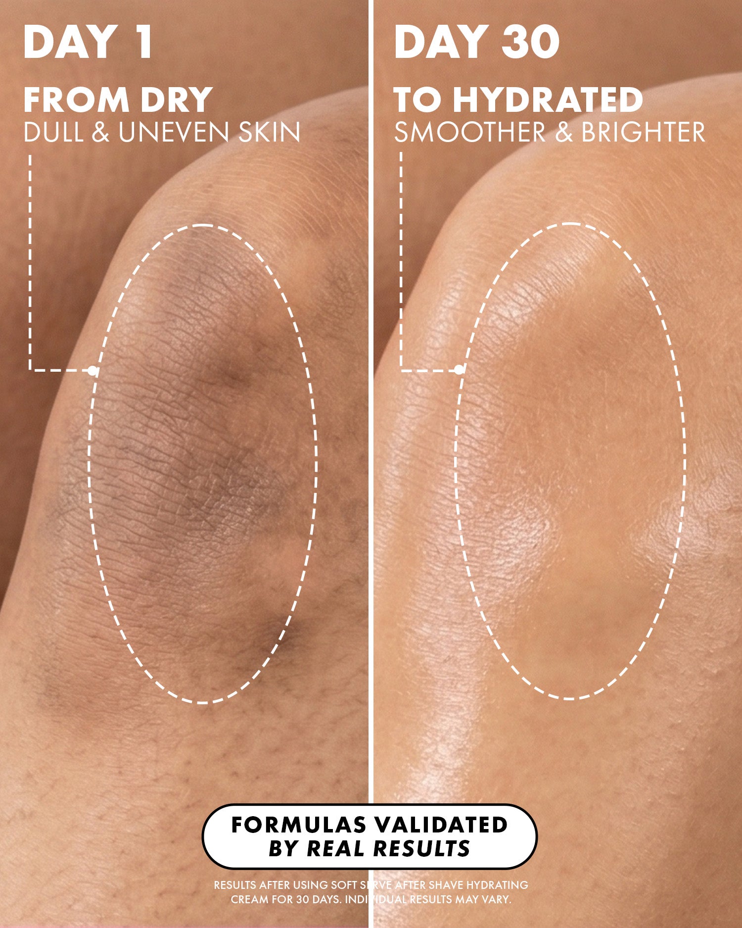 07_BeforeAfterZoomedout_SoftServeHydratingCreamPDP_1500x1875_5372bf65-9083-4c2c-8385-f2e61d36818a.jpg