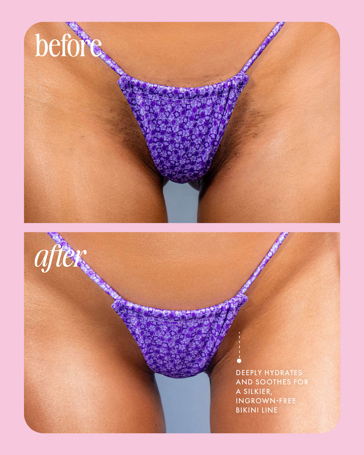 BEFOREAFTER_fb23ff34-1ab3-491c-8e45-74c4eee92645.jpg